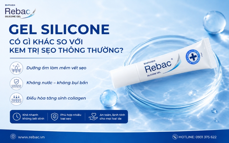 gel silicone có gì khác biệt
