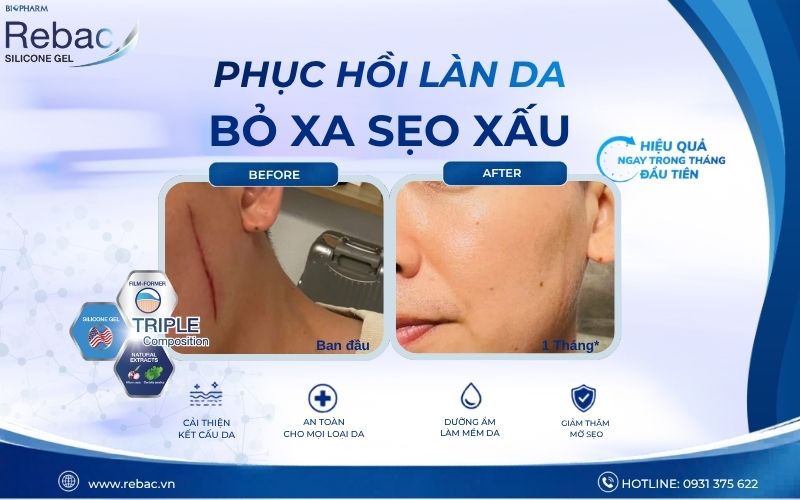 sẹo được hình thành như thế nào